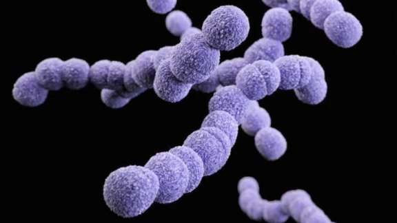 strep a Струга