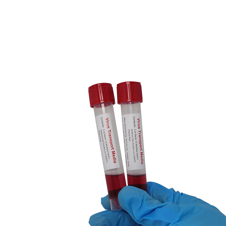 Одноразовий комплект тесту на відбір проб швидкого біологічного вірусу